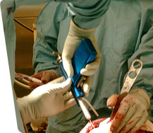 knee operation